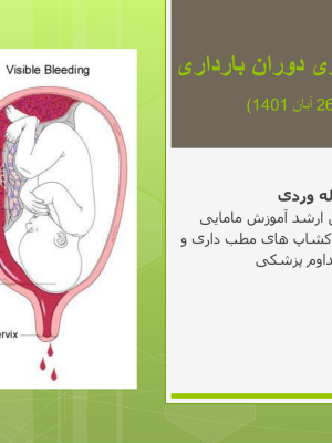 خونریزی دوران بارداری